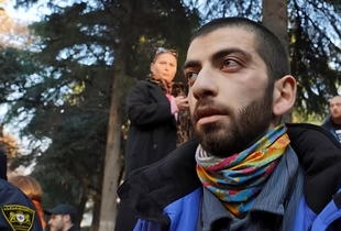 У Тбілісі невідомі напали на грузинського журналіста: він отримав струс мозку