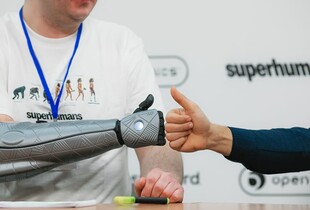 Свириденко анонсувала запуск грантів на біонічні протези та відповіла, коли відбудують "Охматдит"