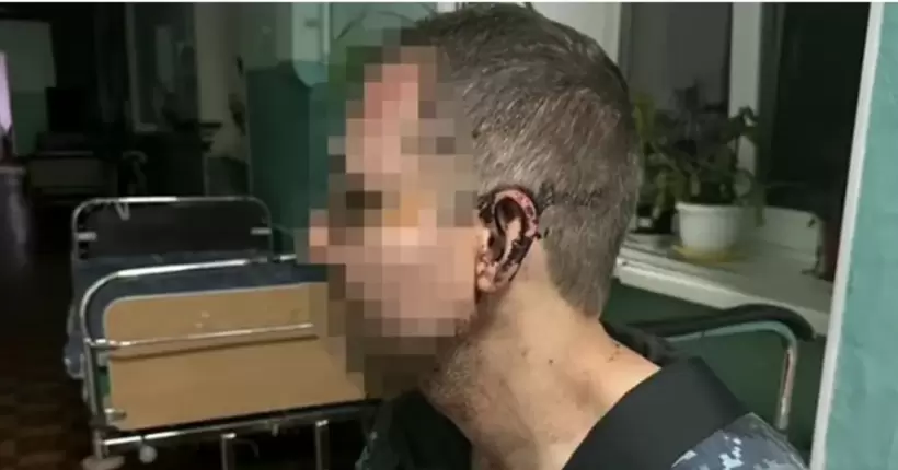 На Одещині в одній з військових частин побили військовослужбовця: справу розслідує ДБР